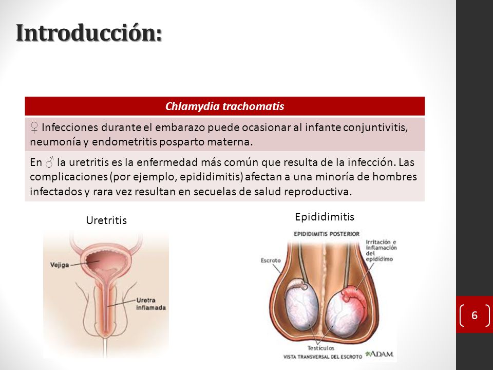 enfermedad de uretritis enfermedad de uretritis